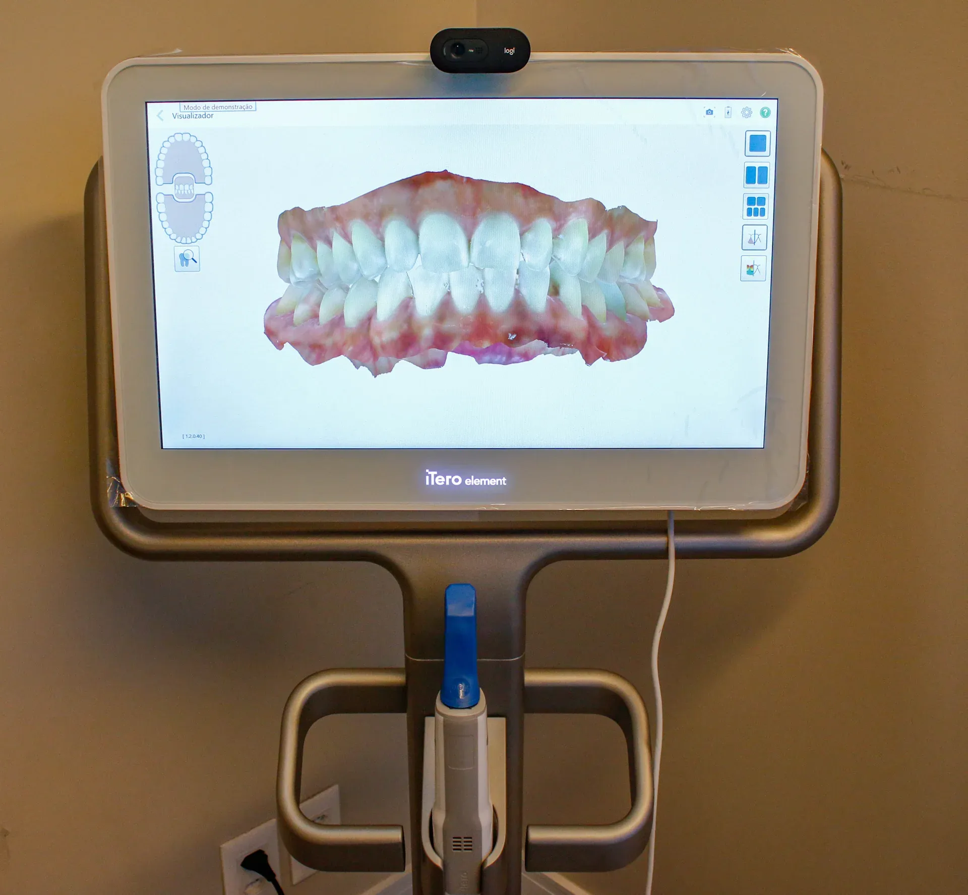Scanner intraoral iTero exibindo modelo 3D da arcada